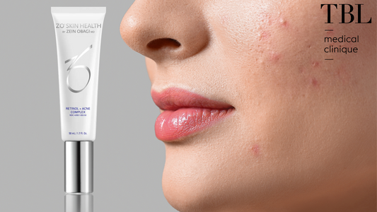 Nyhet fra ZO - Retinol + Blemish Complex
